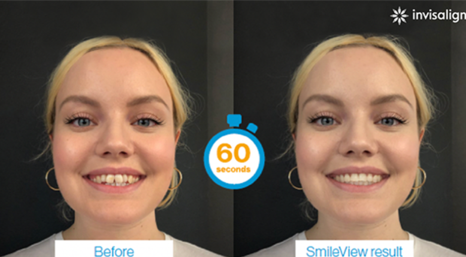Smileview Geneve